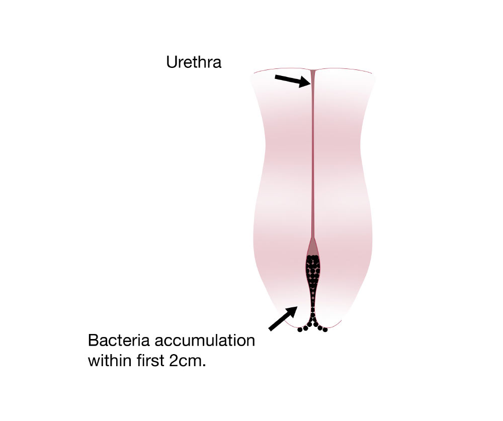 Protecturo - Disinfection of the Urethra - Our approach
